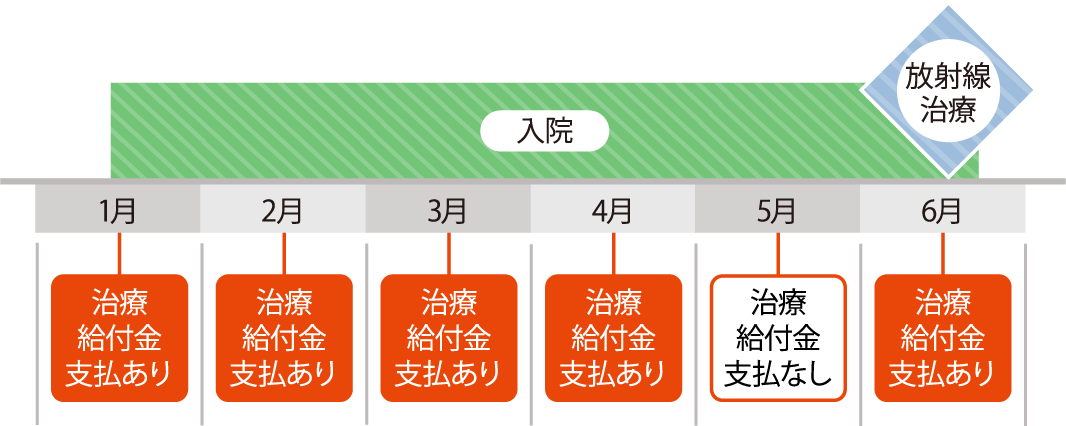 入院 1月 治療給付金支払あり 2月 治療給付金支払あり 3月 治療給付金支払あり 4月 治療給付金支払あり 5月 治療給付金支払なし 6月 放射線治療 治療給付金支払あり