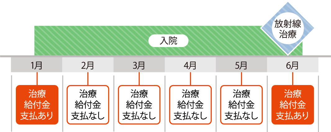 入院 1月 治療給付金支払あり 2月 治療給付金支払なし 3月 治療給付金支払なし 4月 治療給付金支払なし 5月 治療給付金支払なし 6月 放射線治療 治療給付金支払あり